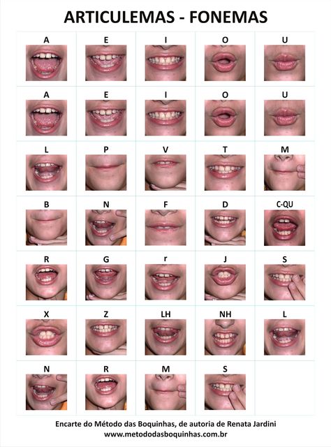 Oral Motor Activities, Speech Articulation, Speech Therapy Games, Speech Language Activities, Phonics Rules, Speech Delay, Oral Motor, Therapy Games, English Phonics