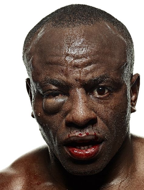 beatup Boxing Injury Face, Beating Up Pose Reference, Punching Reference, Sfx Wound Makeup, Face Injuries, Face Wound, Injury Makeup, Wound Makeup, Side Portrait