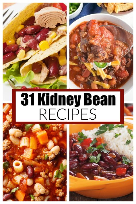 Dried Red Kidney Bean Recipes, Light Kidney Beans Recipes, Kidney Bean Side Dish, What To Make With Kidney Beans, Recipes Using Kidney Beans, Dried Kidney Beans Recipes, Light Red Kidney Beans Recipes, Red Kidney Beans Recipes, Canned Kidney Bean Recipes