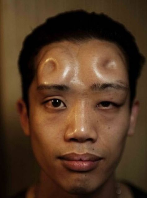 Bagel Head - What Were They Thinking? | Drunk On Pop    http://drunkonpop.com/2012/09/29/what-were-they-thinking-bagel-head/ Weird Fashion Trending, Silicone Implants, Body Modification, Weird Fashion, Body Modifications, Crazy People, New Fashion Trends, Look In The Mirror, Body Mods