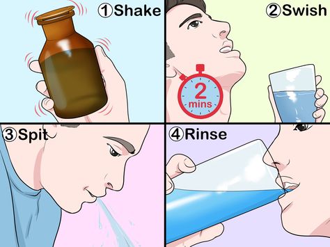 How to Make Hydrogen Peroxide Mouthwash Hydrogen Peroxide Mouth Rinse, Peroxide Mouth Rinse, Magic Mouthwash Recipe, Hydrogen Peroxide Mouthwash, Hydrogen Peroxide Teeth, Food Grade Hydrogen Peroxide, Homemade Mouthwash, Hydrogen Peroxide Uses, Swollen Gum