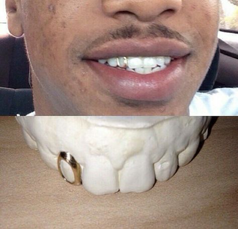 Gold Teeth Grills, Open Face Grillz, Gold Teeth Grillz, Girl Grillz, Teeth Grills, Silver Tooth, Dental Jewelry, Gold Tooth, Grillz Teeth