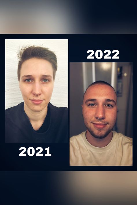 Transition update selfie testosterone ftm pride 🏳️‍🌈🏳️‍⚧️ Testosterone Ftm, Ftm Testosterone, Ftm Pride, Desk, Quick Saves