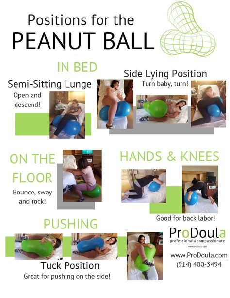 The Peanut Ball: A New Snack or a Tool Used for Birth? Back Labor, Spinning Babies, Labor Positions, Peanut Ball, Birthing Ball, Labor Nurse, Induce Labor, Pregnancy Labor, Childbirth Education