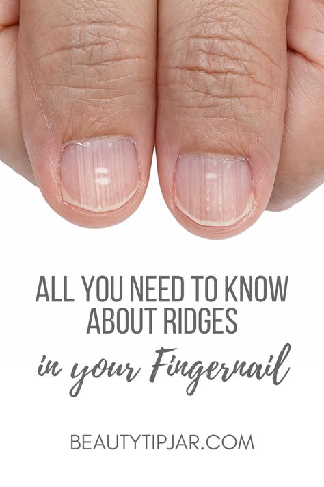 Nail Infection Fingernail Ridges, Healthy Fingernails, Fingernail Health, Nail Remedies, Nail Ridges, Nails Care, Layers Of The Epidermis, Ingrown Toenail, Nail Infection