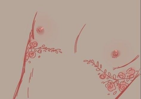 Trans Scar Reference Drawing, Tattoos Top Surgery, Trans Scar Tattoo, Top Surgery Scar Tattoo, Trans Top Surgery Tattoos, Top Surgery Tattoo, Trans Tattoo, Top Surgery, Trans Art