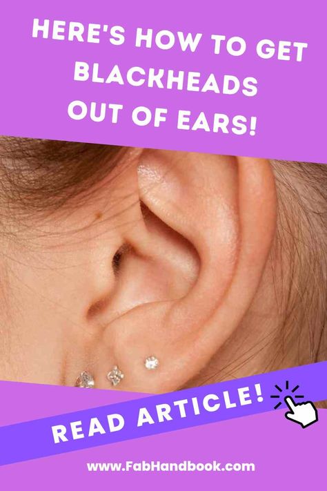 Ears need some TLC? Get ready to banish those pesky blackheads with our expert-approved tips and tricks. And prevent them from coming back again. How To Treat Blackheads, How To Prevent Blackheads, Zit Remedy, Blackhead Remedies, Clean Blackheads, Improve Nutrition, Lower Back Pain Exercises, Cold Medicine, Home Remedy For Cough