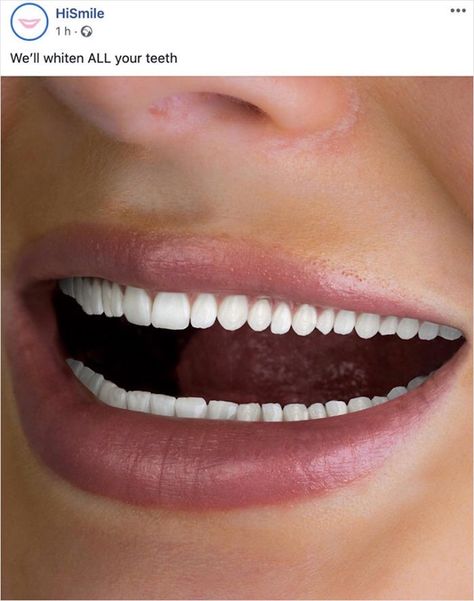 Trending On Pinterest, Trend Quote, Creepy Images, Design Fails, Natural Teeth Whitening, Color Corrector, Bad Design, Dental Practice, Color Correction