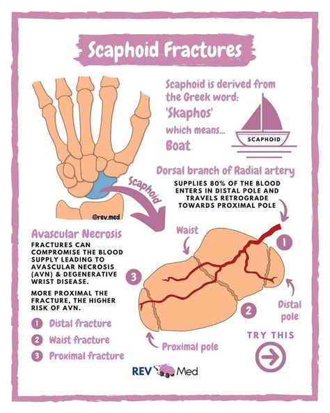 Scaphoid Fracture, Medical Jobs, Education Facts, Anatomy Physiology, Greek Words, Anatomy And Physiology, Disease, Anatomy, Education