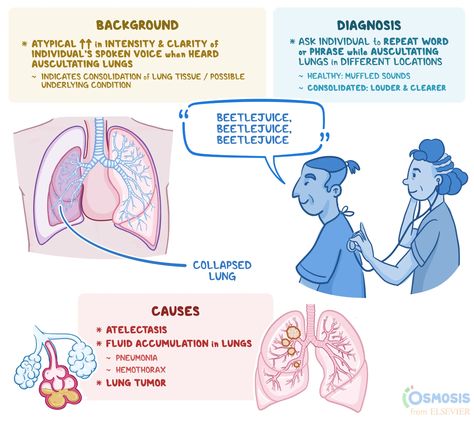 Osteoporosis Nursing, Home Remedies For Bronchitis, Medicine Studies, Medicine Notes, Family Nurse Practitioner, Respiratory Care, Study Essentials, Med Surg, Medical Student Study