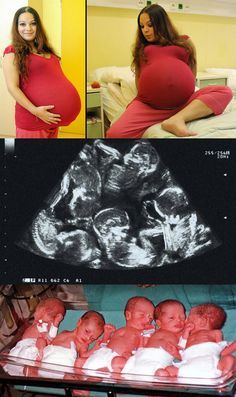 Funny Pregnancy Memes, Postpartum Care Kit, Multiple Births, Pregnancy Memes, Multiples Baby, Pregnancy Humor, Newborn Baby Photography, Instagram Editing, Twin Babies