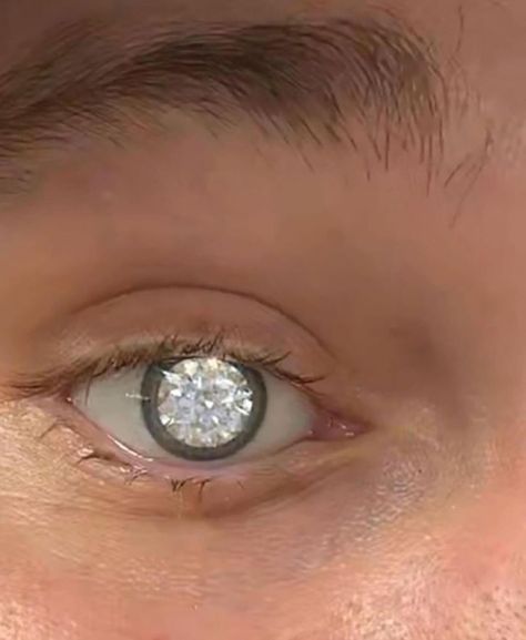 Eye Prosthetic, Glass Eye Prosthetic, Prosthetic Eye, Eye Aesthetic, Eye Surgeon, Diamond Eyes, Glass Eyes, 2 Carat, Cool Eyes