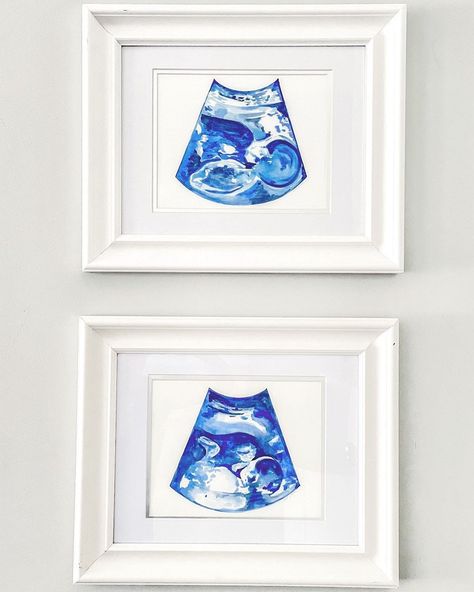 Excited to share this item from my #etsy shop: Custom Sonogram painting, Sonogram art, Original Sonogram painting, Ultrasound painting, Custom Ultrasound art Ultrasound Painting, Ultrasound Art, Custom Painting, Watercolor Paints, Custom Watercolor, Baby Art, Watercolor Techniques, Painting Photos, Ultrasound