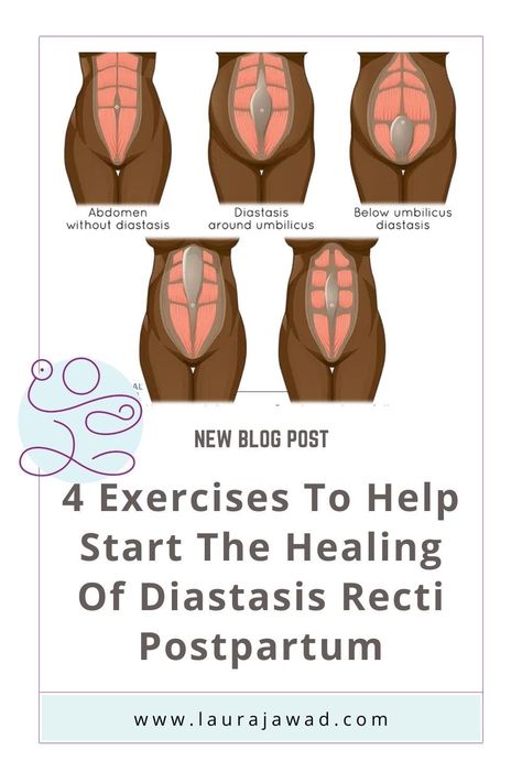 Abdominal Separation Diastasis Recti, Diastasis Recti Wall Exercises, Wall Pilates For Diastasis Recti, Abdominal Exercises After C Section, Diastasis Recti Exercises In Bed, 8 Weeks Postpartum, Fix Diastasis Recti 21 Days, Heal Diastasis Recti Fast, Abdominal Separation Exercises