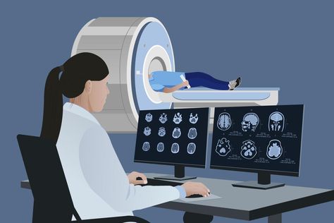 A radiologist analyzes the results of a patient's brain MRI on a computer monitor. Diagnosis of brain diseases in a doctor examining magnetic resonance imaging . Brain Mri, Brain Imaging, Science Powerpoint, Mri Brain, Radiology Student, Medical Diagnosis, Radiology Imaging, Brain Images, Pink Camera