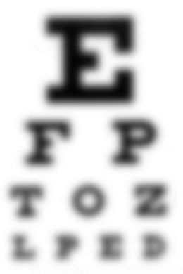 MY EXTREMELY BAD EYES Fat Burning Breakfast, Back Acne Remedies, Blurry Eyes, Bad Acne, Eye Chart, Blurry Vision, Show Me The Way, Ketogenic Recipes, Blur