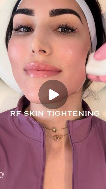 Sheila Shahram on Instagram: "Lately I’ve been obsessed with radio frequency skin tightening to help prevent jowls, sculpt my cheekbones, and keep this jawline snatched 👏🏽 

Thank you so much @nursefiona @nursefionaskin for keeping me looking and feeling 23 at 33 😋

🏷️ #facialtreatment #skintreatment #skintightening #rftreatment #antiaging #jawlinecontouring #facials #cheeklift #jowllift" Facial Before And After, Radio Frequency Facial, Skin Recipes, Cheek Lift, Radio Frequency Skin Tightening, Tighten Facial Skin, Skin Tightening Face, Skin Food, Radio Frequency