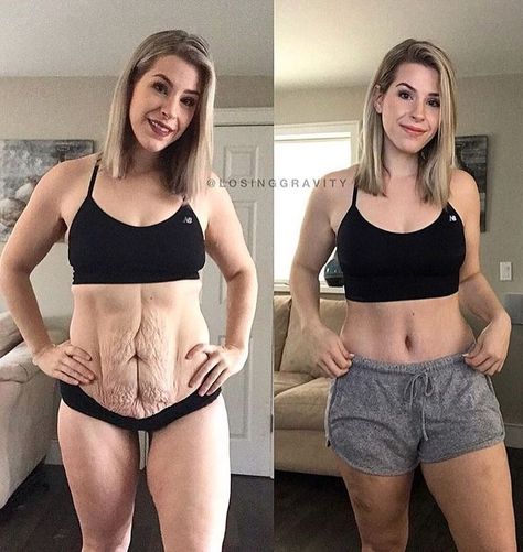 Before and After #momlife #postpartum Diet Vegetarian, Pole Fitness, Loose Skin, Body Fitness, Fat Burning Workout, Fitness Transformation, Transformation Body, Lose Belly, Lose Belly Fat