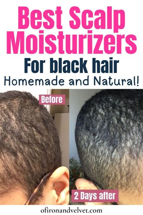 The 4 Best scalp moisturizers for black hair: Easy, cheap and home-made - Of Iron and Velvet Dry Hair Remedies For Black Women, Good Moisturizer For Natural Black Hair, Alopecia Hairstyles Black Women, Fenugreek Water, Scalp Spa, Scalp Moisturizer, Hair Detox, Black Hair Growth, Natural Hair Moisturizer