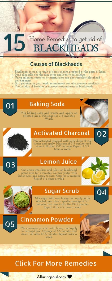 Home Remedies For Blackheads Homemade Peel Off Face Mask, Remedies For Blackheads, Make Skin Glow, Peel Off Face Mask, For Blackheads, Face Mask For Blackheads, Blackhead Remedies, Diy Masks, Mask Recipes