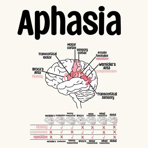 A look at Aphasia 🧠 Study Set Available on my TPT!🩷 . . . . . . . . . . #sIp #speechpathology #sIpgradstudent #sIpgradschool #gradstudent #Speechtherapy #sIpgradlife #speechlanguagepathology #speechlife #slptobe #bilingualslp #cuethespeech #aestheticanatomy #slpaesthetic #lifeisspeechie #fixasha #slpfinds #slpmusthaves #speechfinds #speechie #slpanatomy #anatomy Slp Praxis Study Guide, Speech Therapy Aesthetic, Speech Pathology Aesthetic, Slp Aesthetic, Speech Language Pathology Grad School, Linguistics Study, Praxis Study, Speech Therapy Tools, Slp Materials