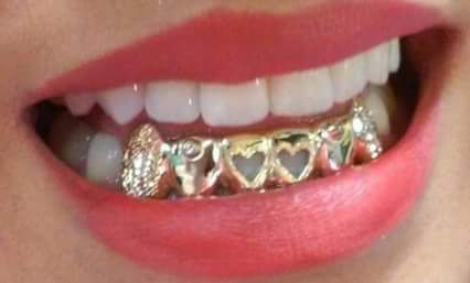 ひ {Loved the pin? Follow @kaezzi for more 🤣} ひ _____________________ Girls With Grills, Gold Teeth Grillz, Girl Grillz, Grillz Teeth, Diamond Grillz, Gold Grill, Diamond Teeth, Gold Grillz, Grills Teeth