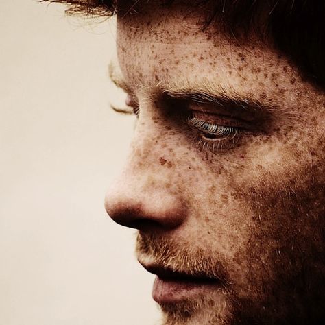 Men look good with freckles, too! - Imgur Freckle Photography, Redhead Men, Beautiful Freckles, Freckle Face, Ginger Men, Post Mortem, Photography Pictures, Ginger Hair, Redheads