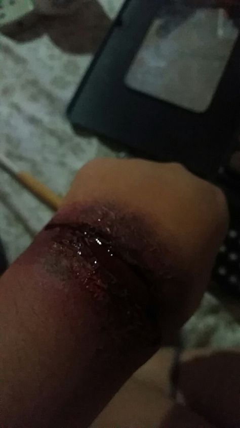 #Wound  #Makeup #Sfx #fx #MakeupLover Wound Makeup, My Makeup, Makeup Lover, Makeup, Make Up