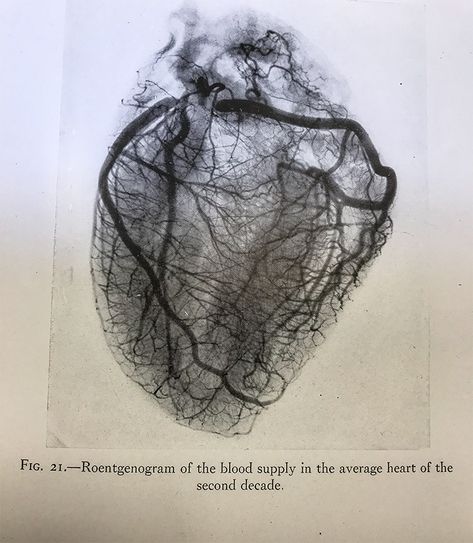 Rib Cage Art, Glass Window Tattoo, Stained Glass Window Tattoo, Cage Art, Window Tattoo, Medical Drawings, Luxury Lifestyle Aesthetic, Anatomy For Artists, Heart Images