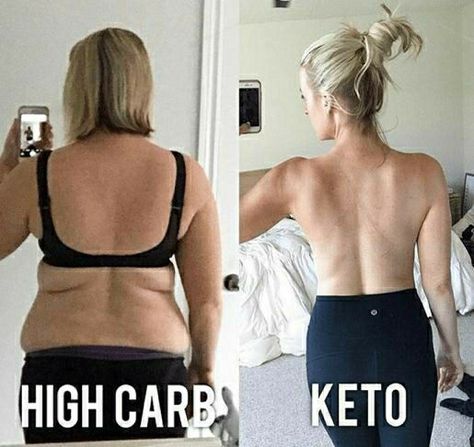 Lose high carb on keto challenge in few weeks.keto diet before and after pictures show just how successful you can be eating all you want and losing fat and looking great all before and after.#loseweightfast#loseweightquickly#loseweight#losebellyfat#skinny#fitness Keto Story, Motivation Stories, Keto Inspiration, Keto Motivation, Health Transformation, Keto Diet Results, Keto Results, Starting Keto Diet, Keto Diet Menu