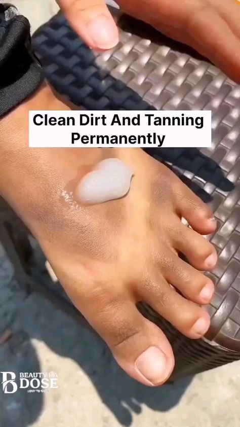 How To Clean Hands At Home, White Legs Skin, Foot Whitening Remedies, Hand And Feet Whitening Remedies, How To Get White Hands, Body Whitening Remedies, How To Get Soft Hands, Ideas De Pedicure, Remedy For Cracked Heels