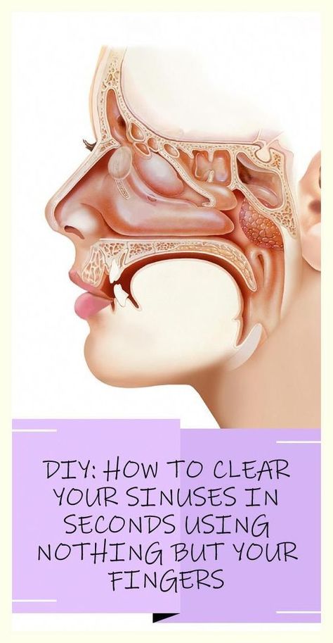 How to Clear Your Sinuses in Seconds Using Nothing but Your Fingers Clear Your Sinuses, Blocked Sinuses, Lymph Drainage Massage, Cold Or Allergies, Lymph Fluid, Lymph Drainage, Sinus Pressure, Fluid Retention, Stuffy Nose