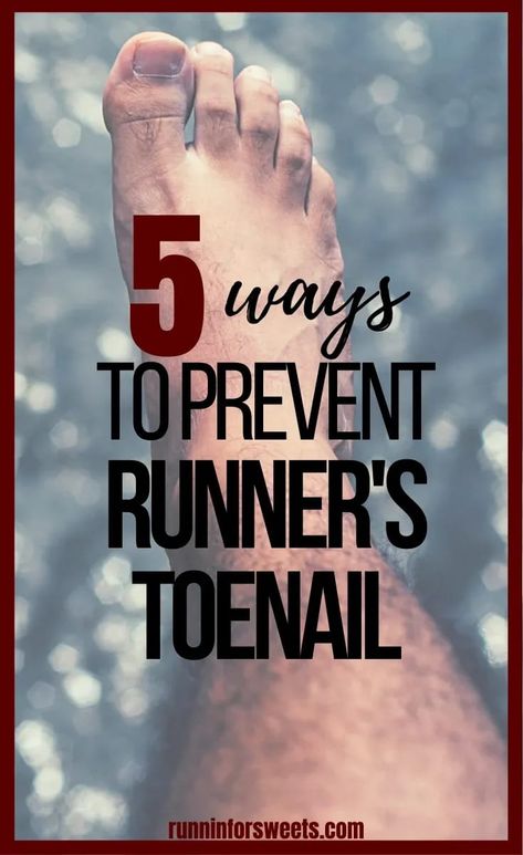 Here is what to do if you have a toenail falling off from running, bruised toenail, or thick runners toenail. These 5 tips will help heal and prevent issues in the future. How To Save A Toenail From Falling Off, Runners Toenails, Toenail Fell Off, Haircuts Color, Nail Falling Off, Hair Colour Ideas, Two Tone Hair, Color Hairstyles, Cool Short Hairstyles