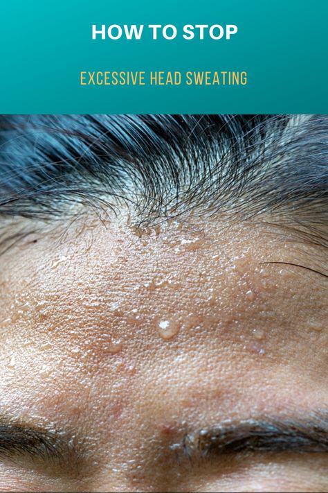 Excessive head sweating is bothering you? Here you can find out when the sweat production is excessive and how to counteract it. How To Sweat Less, Botox For Sweating, Excessive Sweating Remedies, How To Reduce Sweating, Sweating Remedies, Over Sweating, Sweating Too Much, Face Sweating, Nose Picking