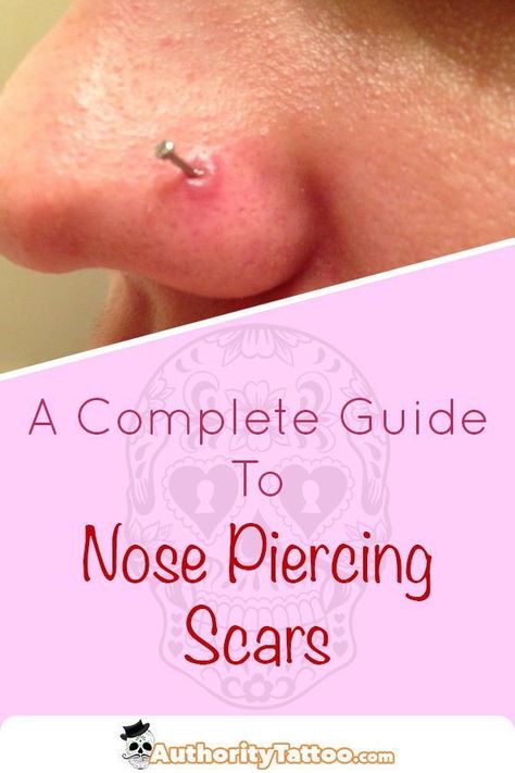 Nose Piercing Scar, Nose Piercing Care, Small Nose Piercing, Nose Piercing Healing, Nose Piercing Bump, Piercing Bump, Cute Nose Piercings, Nose Piercing Stud, Small Nose