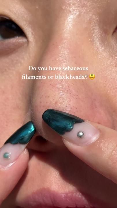 Soo Youn Lee on TikTok Sebaceous Filaments, Rid Of Blackheads, Acne Cleansers, Perfect Skin Care Routine, Get Rid Of Blackheads, Healthy Skin Tips, Facial Skin Care Routine, Body Skin Care Routine, Beauty Skin Care Routine