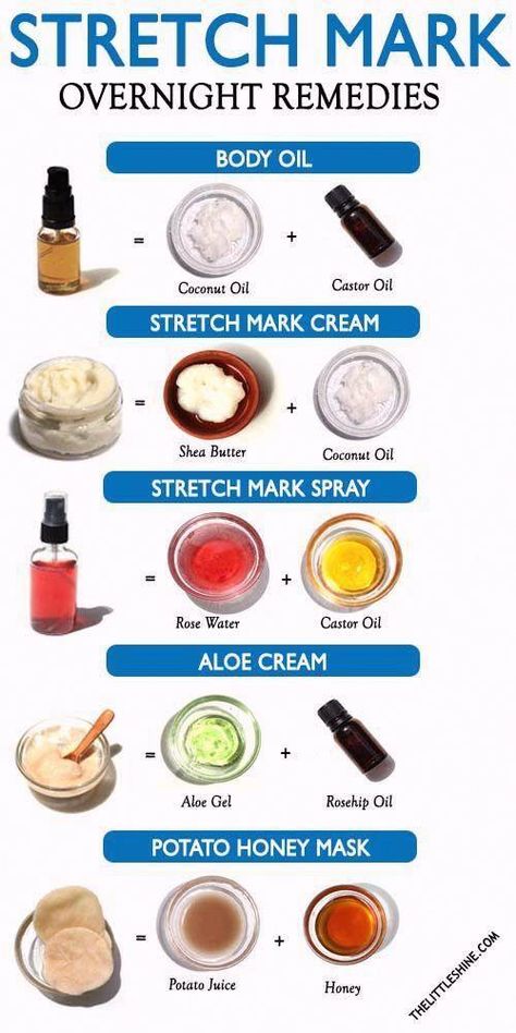 Overnight Remedies, Aloe Cream, Stretch Mark Remedies, Marks Cream, Lotion For Oily Skin, Stretch Mark Cream, Ayurvedic Remedies, Stretch Mark Removal, Aloe Gel