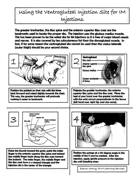 Ventrogluteal IM injections Im Injection, Greater Trochanter, Nursing Humor, Gluteus Medius, Med Tech, Nurse Humor, Nursing, Humor, Humour