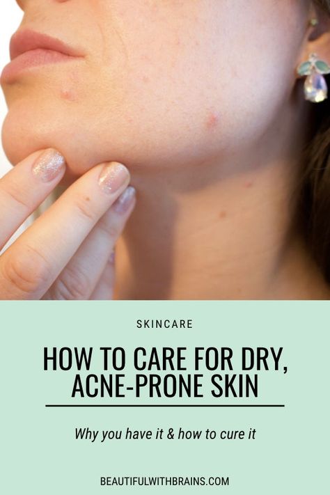 Dry And Acne Prone Skin, Dry Skin Acne Skincare, Skincare Routine For Dry Sensitive Acne Prone Skin, Skin Care For Dry Acne Prone Skin, Dry Acne Prone Skin Routine, Skin Care Routine For Acne Prone Skin, Dry Skin With Acne, Dry Acne Prone Skin, Skincare Routine For Dry Skin