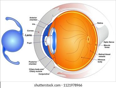 Intraocular lenses: (IOLs) are medical devices that are implanted inside the eye to replace the eye's natural lens when it is removed during cataract surgery. Eye Health Facts, Multifocal Lenses, Laser Vision, Eye Surgeon, Ap Chemistry, Eye Clinic, Eye Hospital, Dr Reid, Mechanical Power