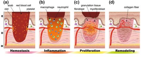 Wound Healing Stages, Granulation Tissue, Blood Clotting, Epidermal Growth Factor, Medical Notes, Nursing Process, Skin Grafting, Collagen Fibers, Family Nurse Practitioner