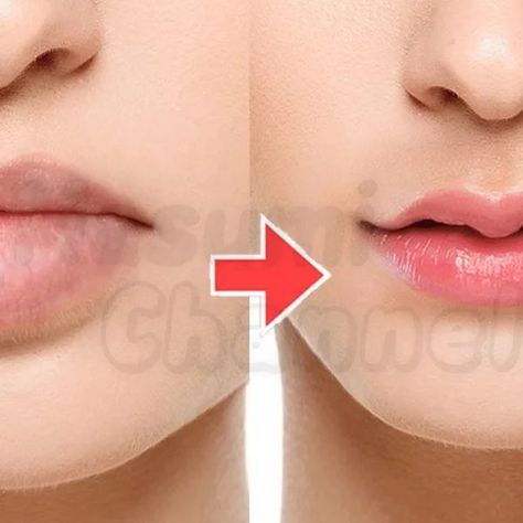 Small Lips Exercise, Heart Lips Shape, Lips Exercise, Facial Workout, Heart Shaped Lips, Small Lips, Facial Exercises, Face Lift, Small Heart