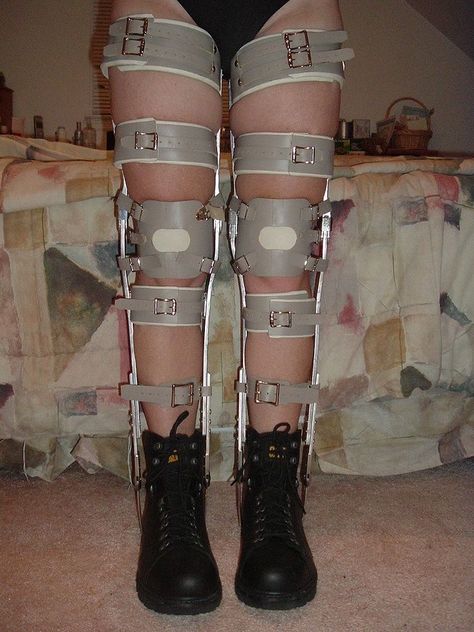 Kafo Leg Braces, Amputee Oc, Disabled Oc, Milwaukee Brace, Jhin League Of Legends, Orthopedic Brace, Braces Girls, Prosthetic Leg, Leg Braces