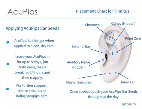 Ear Seeds Placement Chart, Ear Reflexology, Ear Seeds, Reflexology, Natural Remedies, Seeds