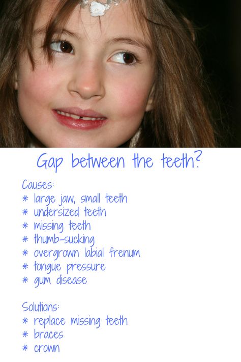 While we can't escape genetics, we can discourage behaviours like thumb-sucking to avoid creating a gap between the two front teeth.  Clinically, this is called "diastema" and depending on the cause, can be fixed by fitting crowns (if the teeth are genetically undersized), by wearing orthodontic devices to close the gap or by replacing any missing teeth. Braces With Gap Teeth, Gap Teeth Aesthetic, Teeth Gaps Aesthetic, Gap Between Teeth, Gapped Teeth, Dental Infographics, Tooth Gap, Tooth Pain Relief, Teeth Aesthetic