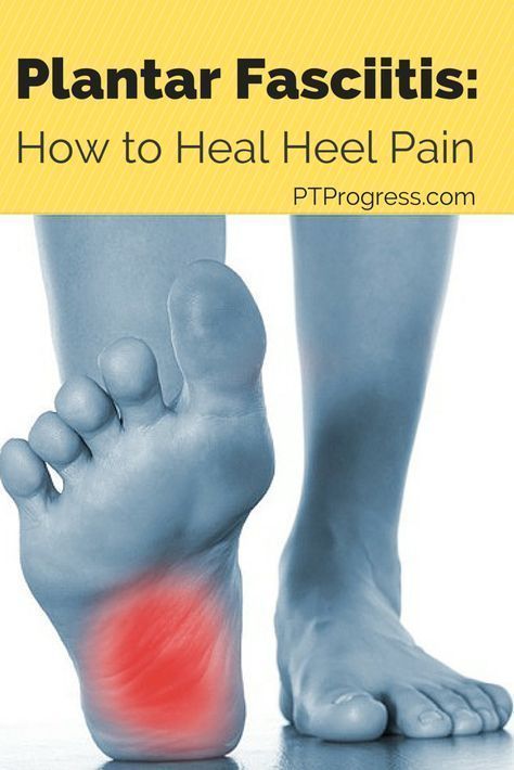 Facitis Plantar, Pain Relief Remedies, Back Pain Remedies, Foot Pain Relief, Joints Pain Relief, Heel Pain, Nerve Pain, Back Pain Relief, Foot Pain