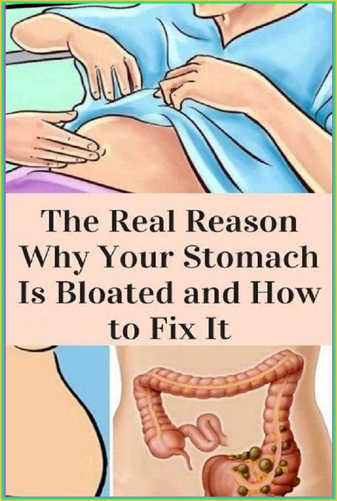 The Real Reason Why Your Stomach Is Bloated And How To Fix It Stomach Swelling, Bloated Stomach, Bloated Belly, Acid Reflux, Health Risks, Health Issues, Reason Why, Bye Bye, Health Remedies