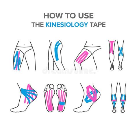 How to use the kinesiology tape. Kinesiology taping of the legs, knees, foot, tendon, ligaments vector illustration Physio Tape, K Tape, Kt Tape, Kinesio Taping, Sports Tape, Kinesiology Taping, Muscle Contraction, Trigger Points, Sports Medicine