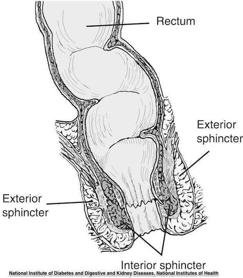 Rectal Prolapse: The Basics Intestines Anatomy, Levator Ani, Rectal Prolapse, Pelvic Floor Muscle Exercise, Sigmoid Colon, Large Bowel, Cleft Lip And Palate, Stool Softener, Cleft Palate