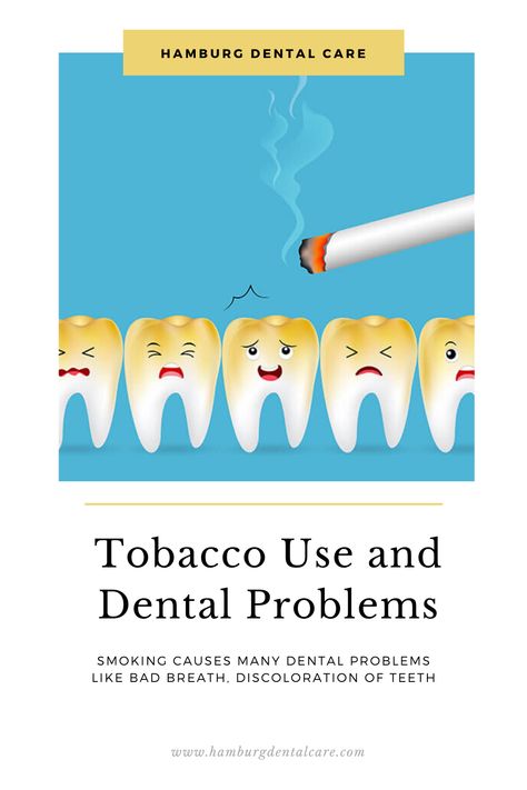 Smoking causes oral issues, like bad breath, discoloration of teeth and other long-term dental problems, read full blog to know more   #DentalTips #DentalHealth #Smoking #Tobacco #DentalProblems Dental Decay, Dental Tips, Bad Breath Remedy, Dental Cavities, Teeth Health, Tooth Sensitivity, Stronger Teeth, Dental Problems, Teeth Care